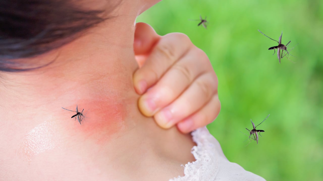 Las picaduras de mosquitos afectan más a unas personas que a otras.