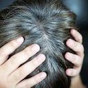 Canas / Despigmentación del pelo.