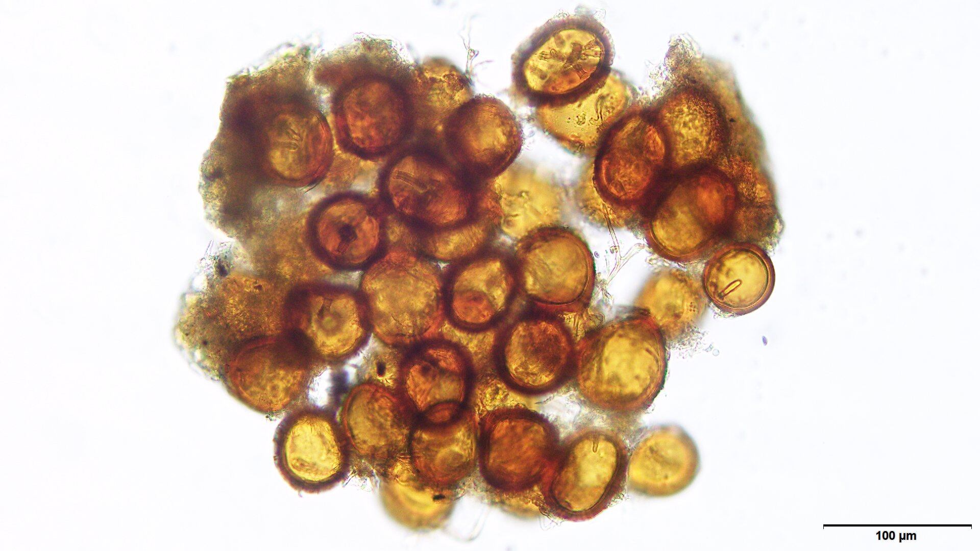 Esporas de hongos de micorriza.