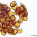 Esporas de hongos de micorriza.