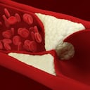 El colesterol alto puede traer graves afectaciones para el cuerpo humano.