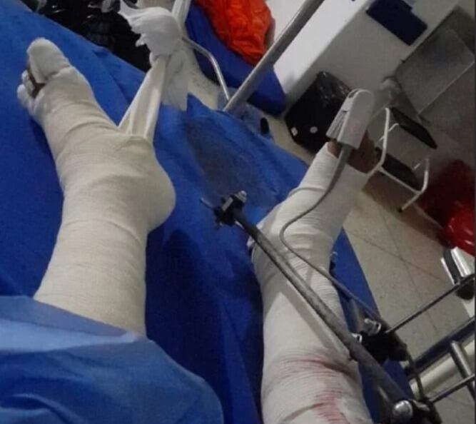 El menor resultó herido en sus dos piernas