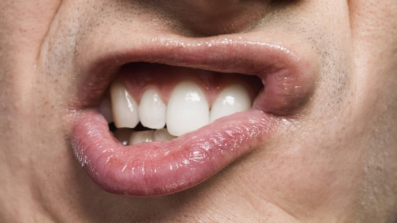 Remedios caseros ayudan a  eliminar el dolor generado por las caries. Foto Gettymages.