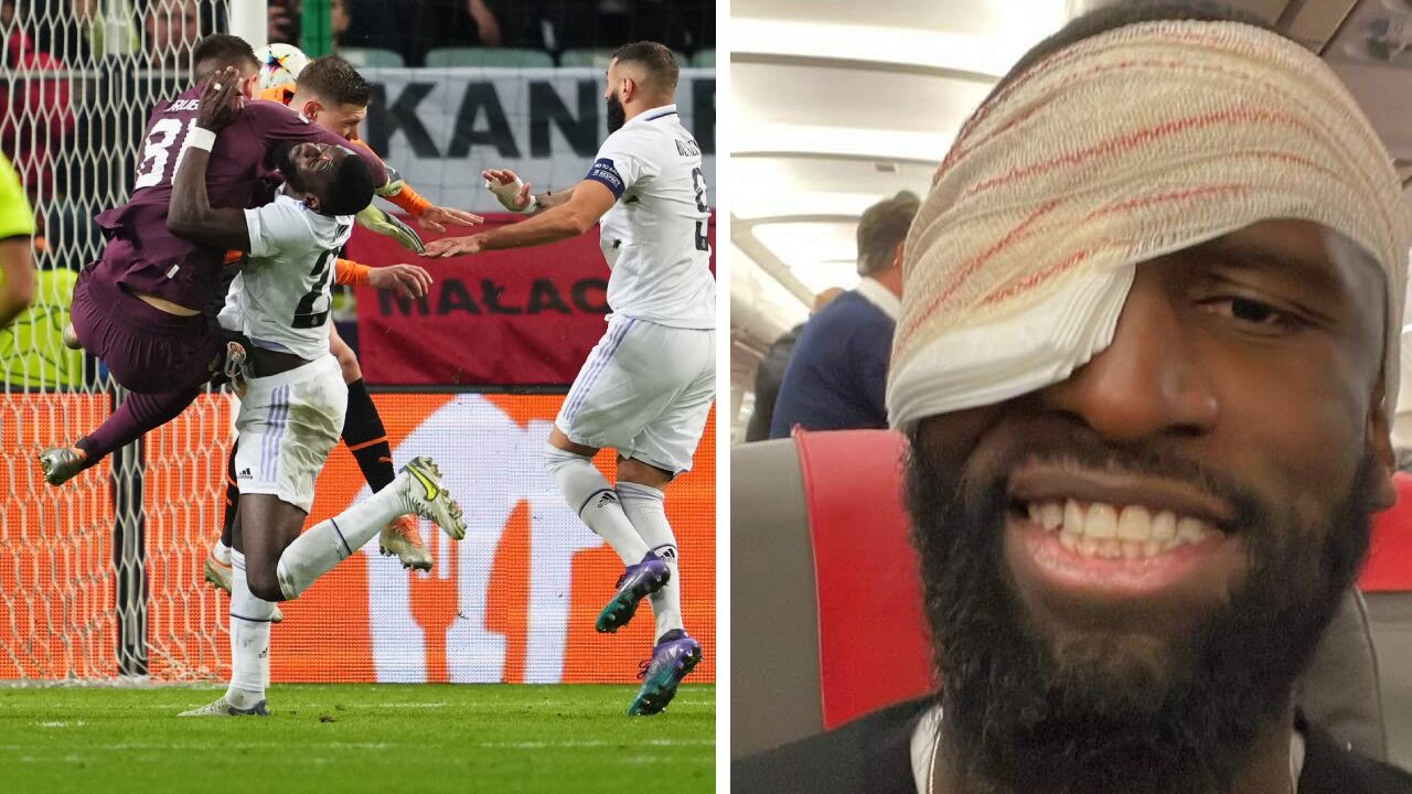 Rüdiger es duda para el clásico del domingo frente a Barcelona