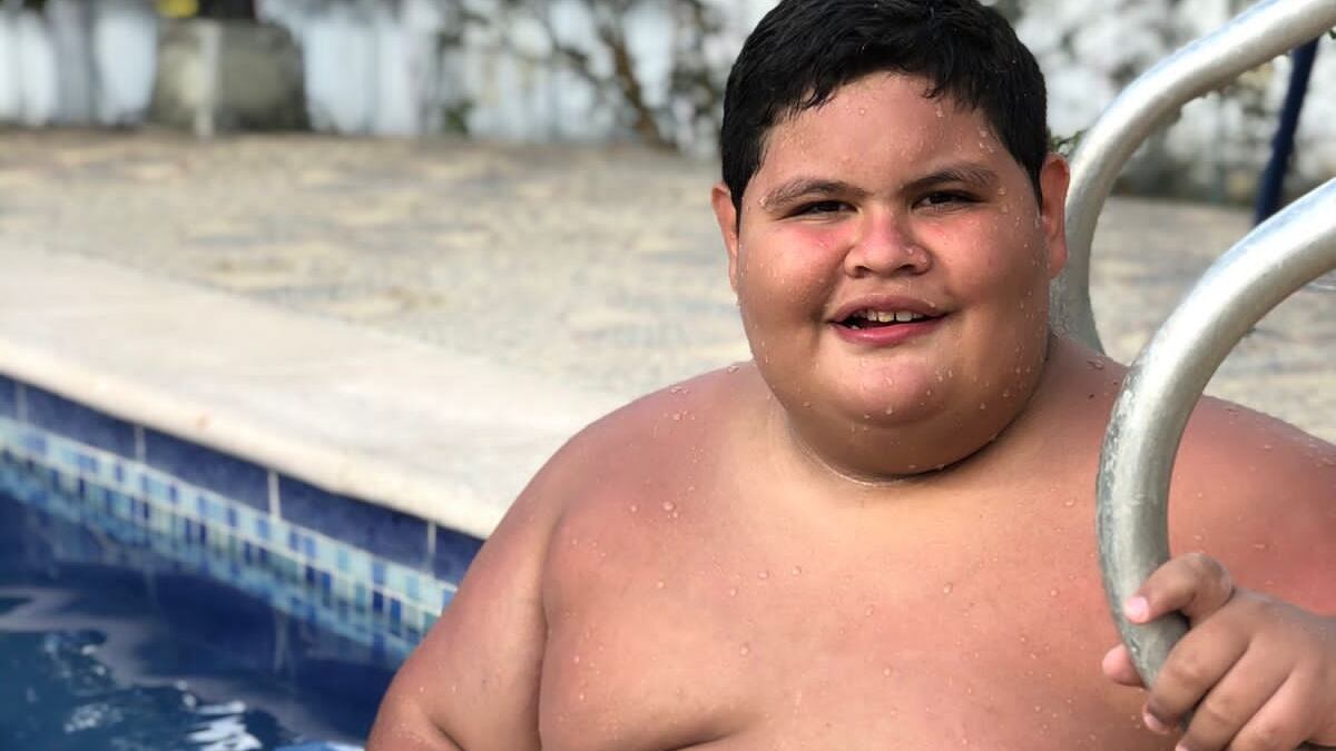 ‘Alejo’ está en proceso de pérdida de peso para lograr calidad de vida con la Fundación ‘Gorditos de corazón’.