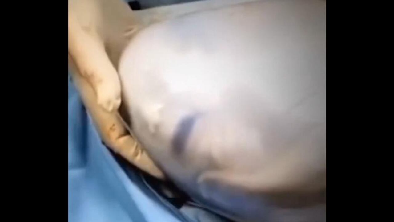 Parto velado
