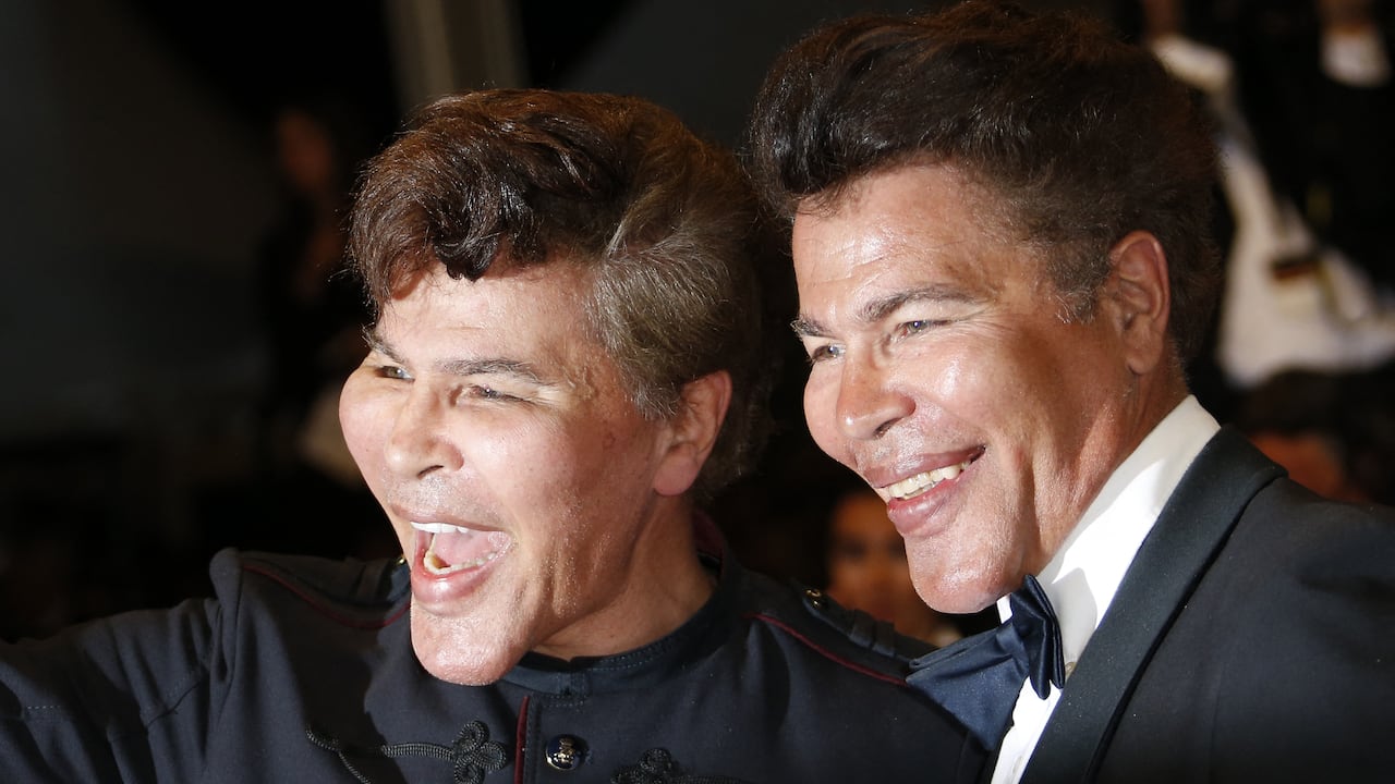 Con seis días de diferencia los gemelos más famosos de Francia murieron. (Photo by Valery HACHE / AFP)