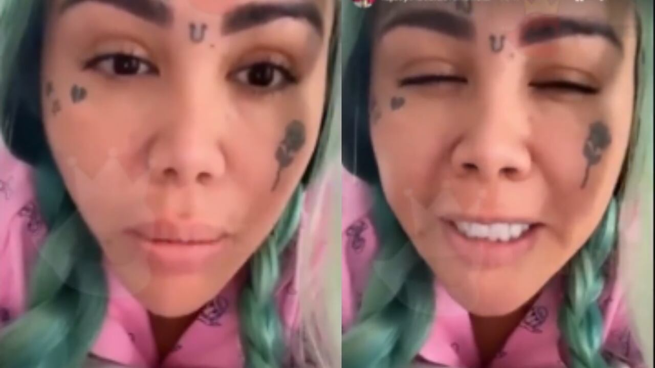 Yina Calderón contó que el proceso ha sido doloroso, pero avanza satisfactoriamente en su recuperación.