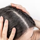 Melena saludable y libre de caspa: Los mejores remedios naturales.