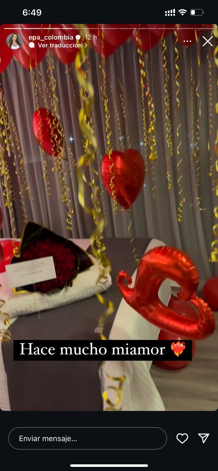 Sorpresa de Karol Samantha a Epa Colombia tras cirugía estética