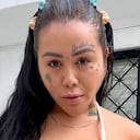 Yina Calderón se sometió a procedimiento para eliminar uno de los tatuajes de su cuello.