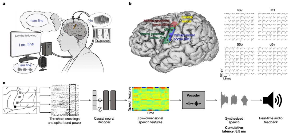 Pacientes con parálisis podrían comunicarse nuevamente mediante tecnología cerebral.