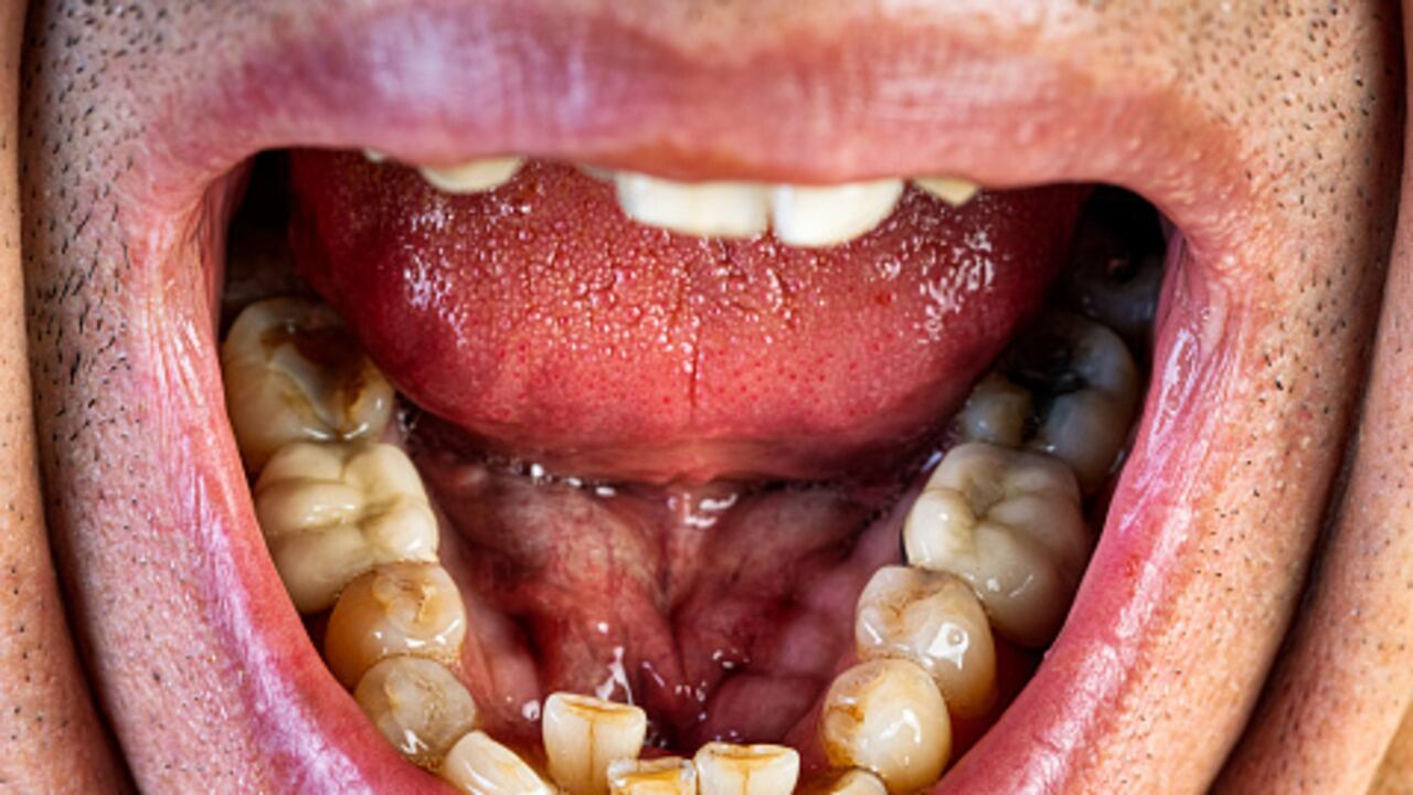 Propagación de enfermedades contagiosas