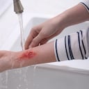 Enfermedades como la diabetes pueden incidir o demorar los procesos de cicatrización.