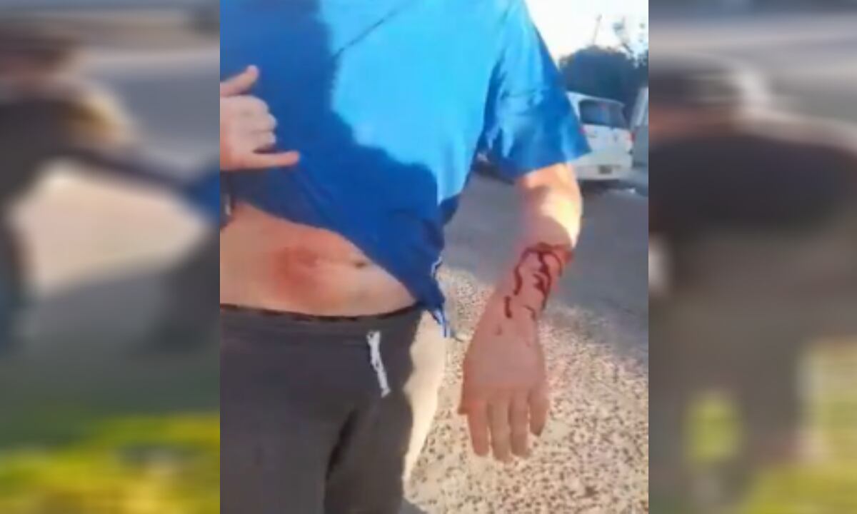 Pitbull genera graves heridas a estudiante.