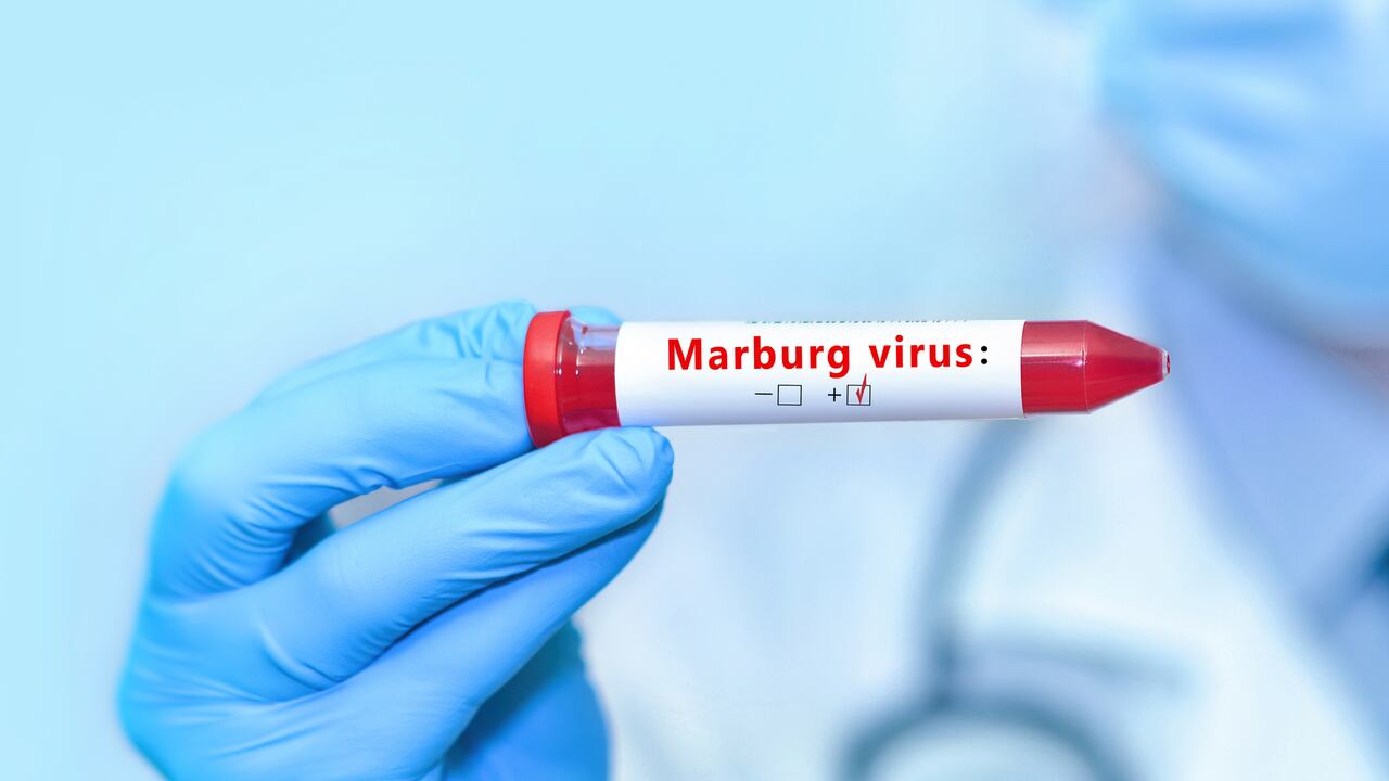 Virus de Marburgo