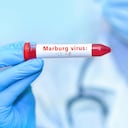 Médico sosteniendo un tubo de muestra de sangre de prueba con virus de Marburgo positivo.