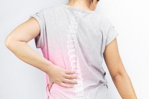 Las fracturas en la espalda y cadera pueden ser recurrentes por cuenta de la osteoporosis.