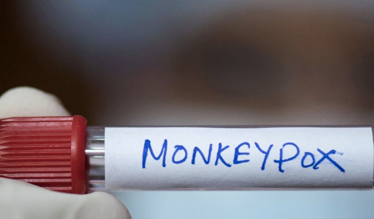 Colombia también está entre los primeros países con más contagios de viruela de mono.