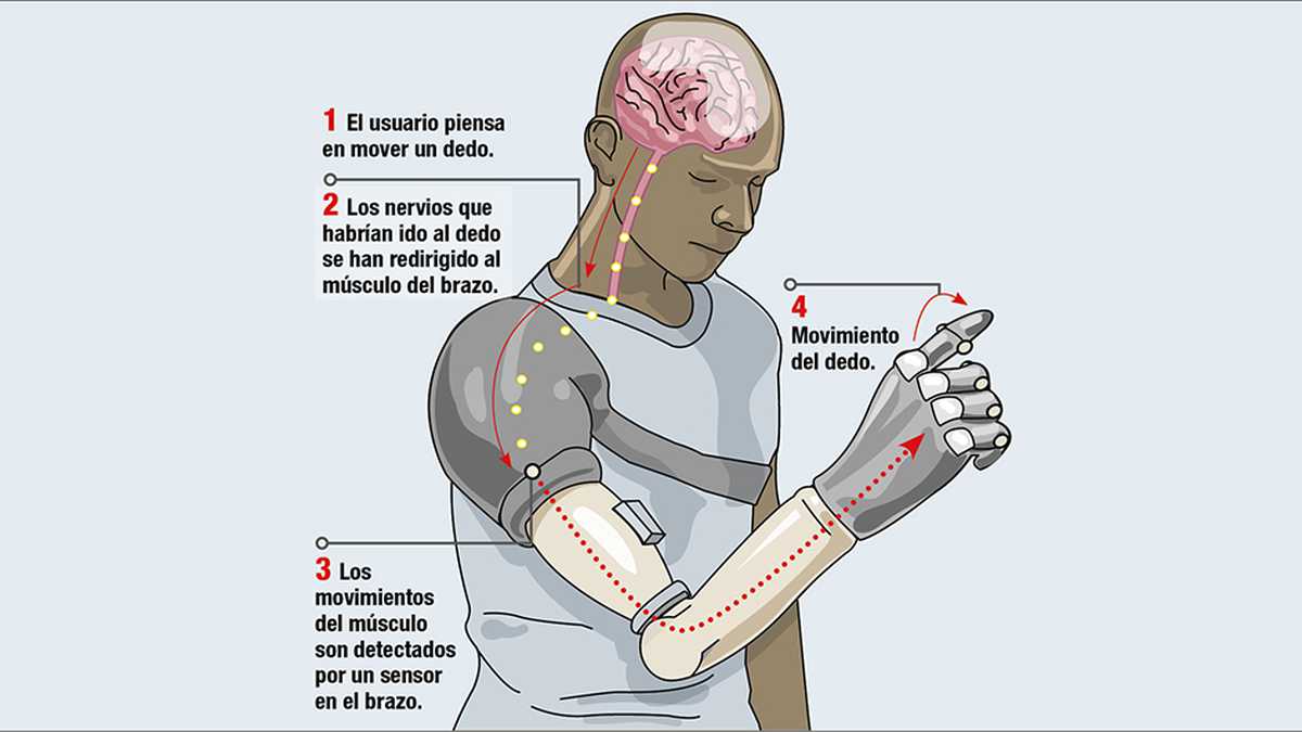 El brazo artificial creado por los científicos estadounidenses devuelve el sentido del tacto.