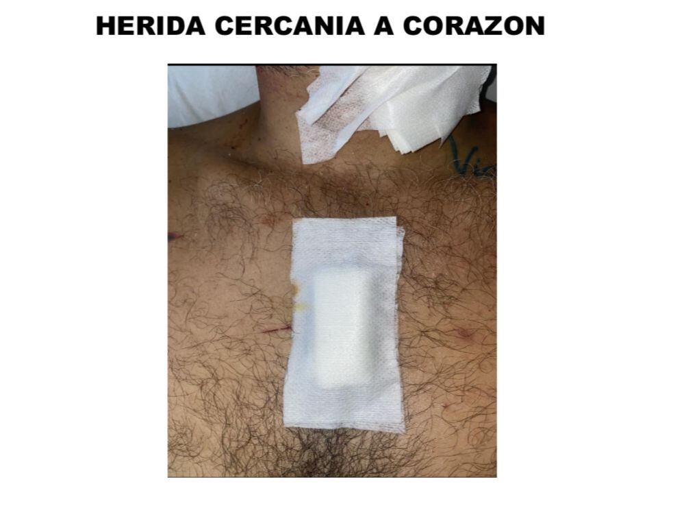 Imágenes de las heridas que sufrió Mauricio Gutiérrez.