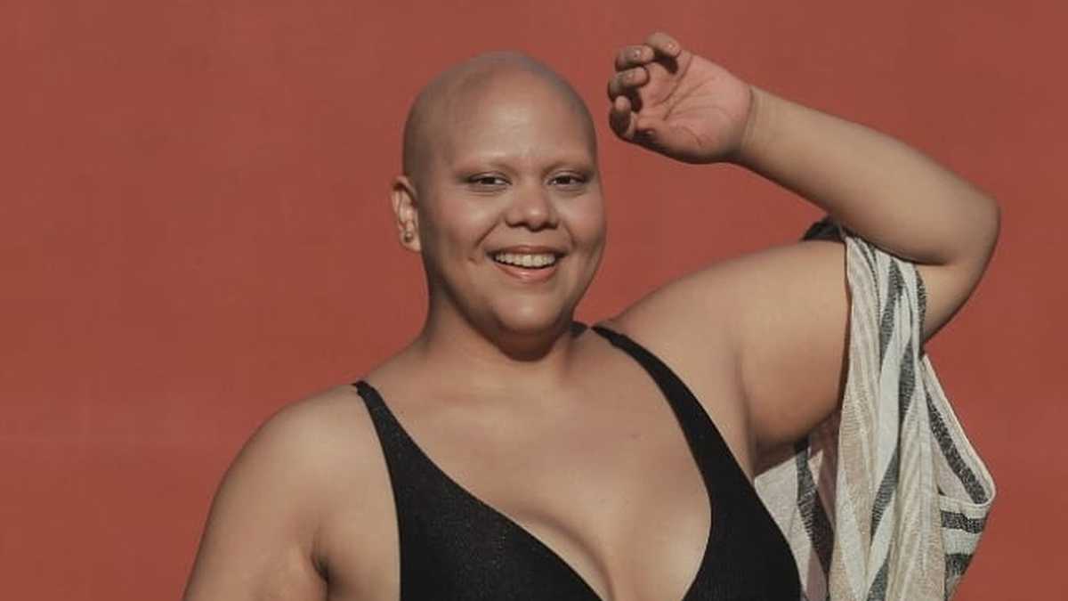 Calva con curvas”: la historia de la modelo «plus size» con alopecia que  lucha contra la violencia estética