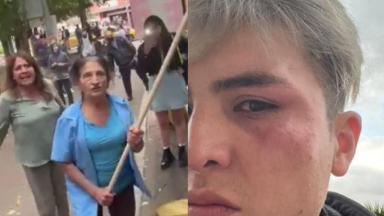 Una pareja gay fue golpeada en Bogotá luego de darse un beso en un parque