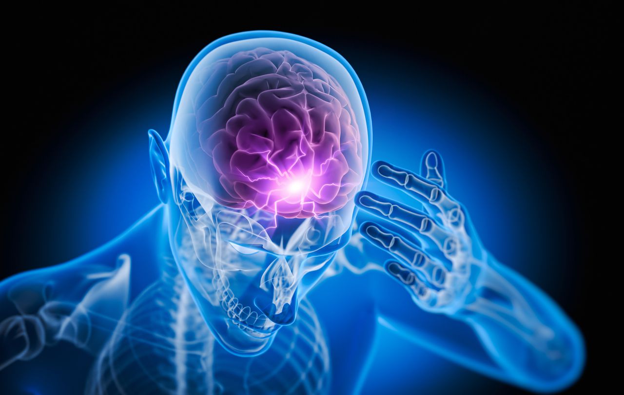 Ilustración médica de rayos X de un hombre con fuerte dolor de cabeza - Ilustración 3D