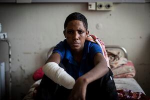Haftom Gebretsadik, un joven de 17 años de Freweini, Etiopía, cerca de Hawzen, a quien le amputaron la mano derecha y perdió los dedos de la izquierda después de que una bala de artillería golpeara su casa en marzo, se sienta en su cama en el Hospital de Referencia Ayder en Mekele , en la región de Tigray, en el norte de Etiopía, el jueves 6 de mayo de 2021. “Estoy muy preocupado”, dijo. "¿Cómo puedo trabajar?" (Foto AP / Ben Curtis)