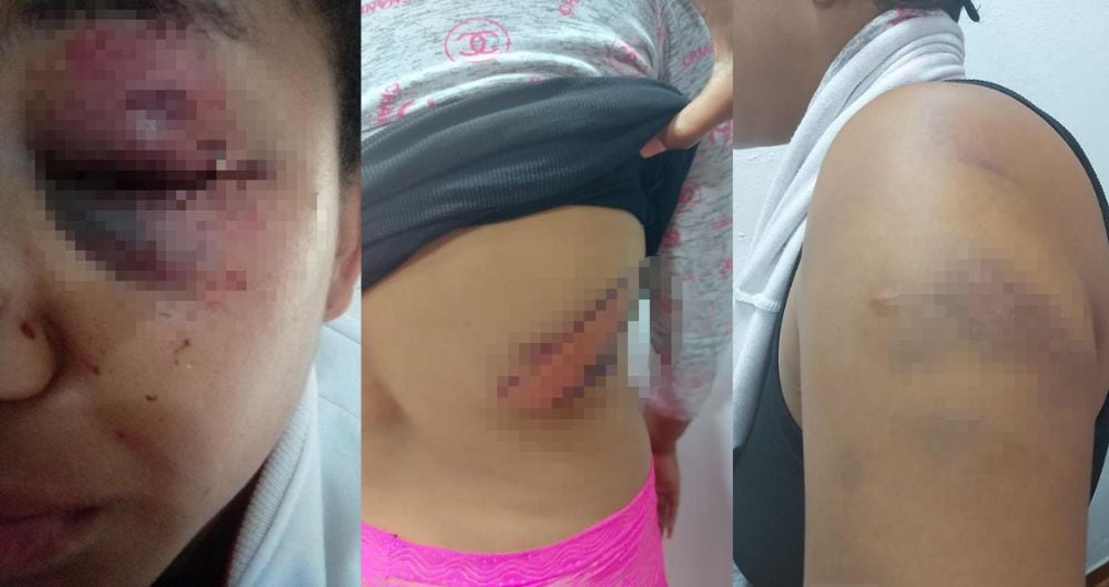 Brutal golpiza a una mujer en Bahía Solano, Chocó.