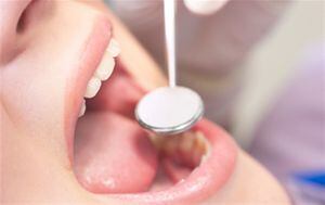 La limpieza dental profesional parece reducir el crecimiento bacteriano que causa inflamación y que puede conducir a enfermedad del corazón y ECV. (Foto: Thinkstock) 