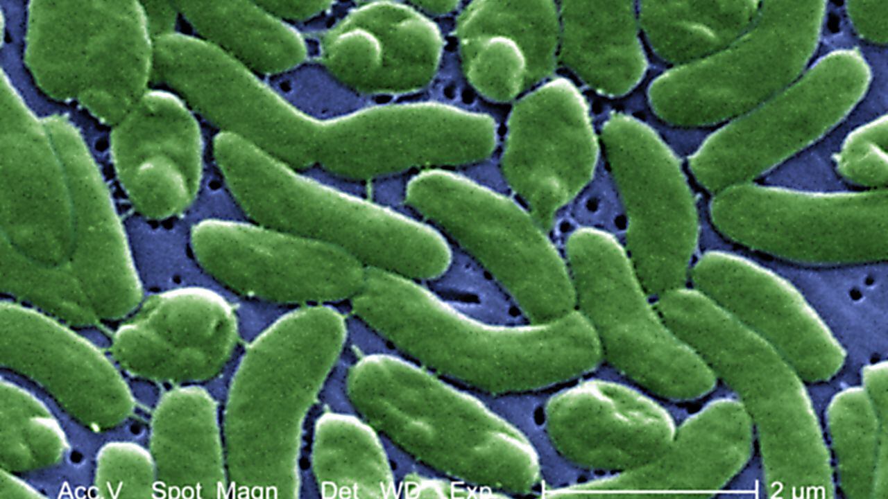 Agrupación de la bacteria Vibrio vulnificus revelada en la imagen microscópica electrónica de barrido (SEM) ampliada 13184x, 2005. Imagen cortesía de los Centros para el Control de Enfermedades