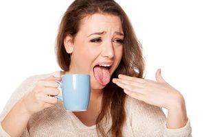 young woman with burned tongue from her hot tea