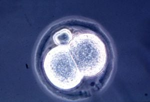 Vista microscópica de un embrión de ratón de dos células, resultado de una técnica de clonación nueva y relativamente simple descubierta por científicos de la Universidad de Hawaii en julio de 1998. Los científicos han creado docenas de ratones clonados, lo que marca la primera clonación documentada de mamíferos adultos desde que los investigadores Escocia anunció el nacimiento de Dolly The Sheep el año pasado. (Foto de Getty Images)