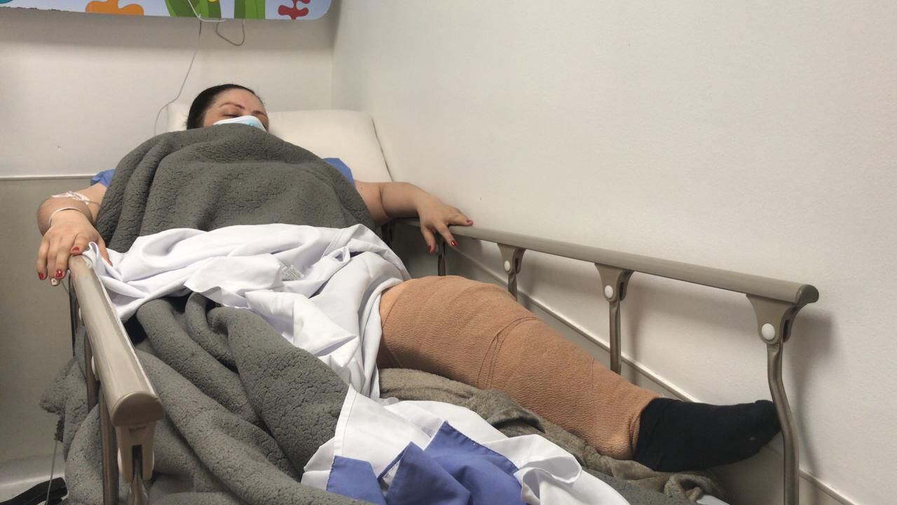 Juliana Salazar fue abordada por un hombre en moto entre las calles 66 y 67 en Chapinero con carrera octava. El ladrón le robó el celular, la atropelló con su vehículo y le fracturó la tibia de su pierna izquierda.