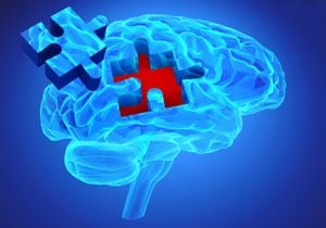 El Alzheimer es una enfermedad cerebral que afecta  la memoria, el pensamiento, el carácter o la manera de comportarse.