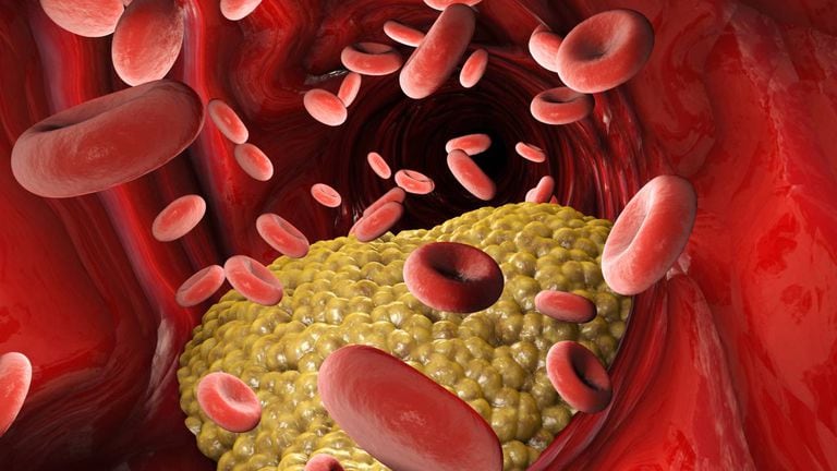 Es importante diferenciar a los Los triglicéridos del colesterol. Lo importante es mantener estables sus niveles en el organismo. Foto: Getty Images.